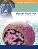 Thyroid_Cancer
