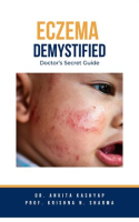 Eczema_Demystified__Doctor_s_Secret_Guide